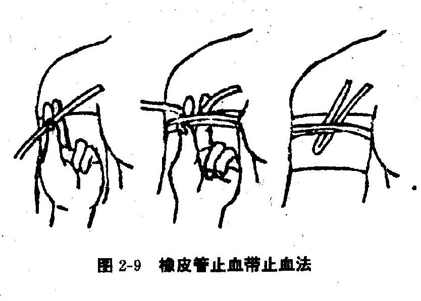 橡胶止水带固定方式图片